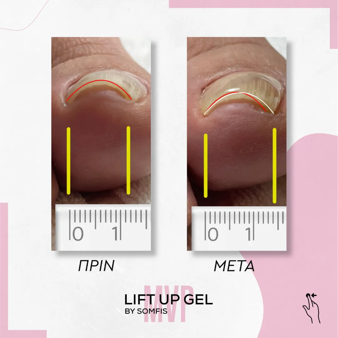 Lift Up Top - picture 2